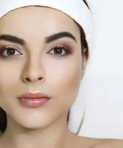 Crow's feet treatment area around the eyes for neuromodulator injections in St. Petersburg FL